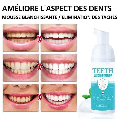 Mousse Blanchiment Dentaire - BrightSmile™