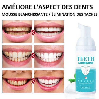 Mousse Blanchiment Dentaire - BrightSmile™