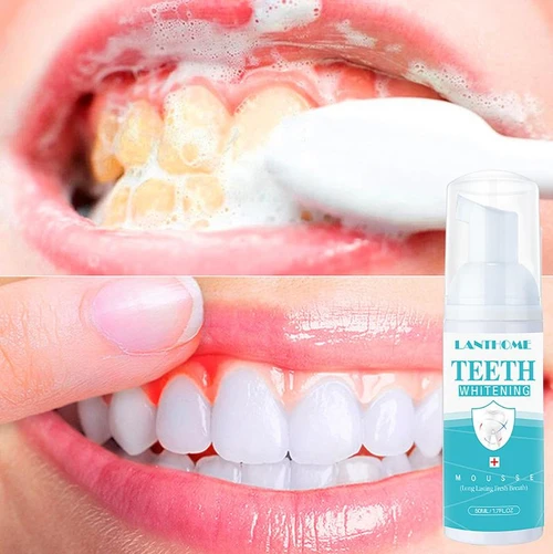 Mousse Blanchiment Dentaire - BrightSmile™